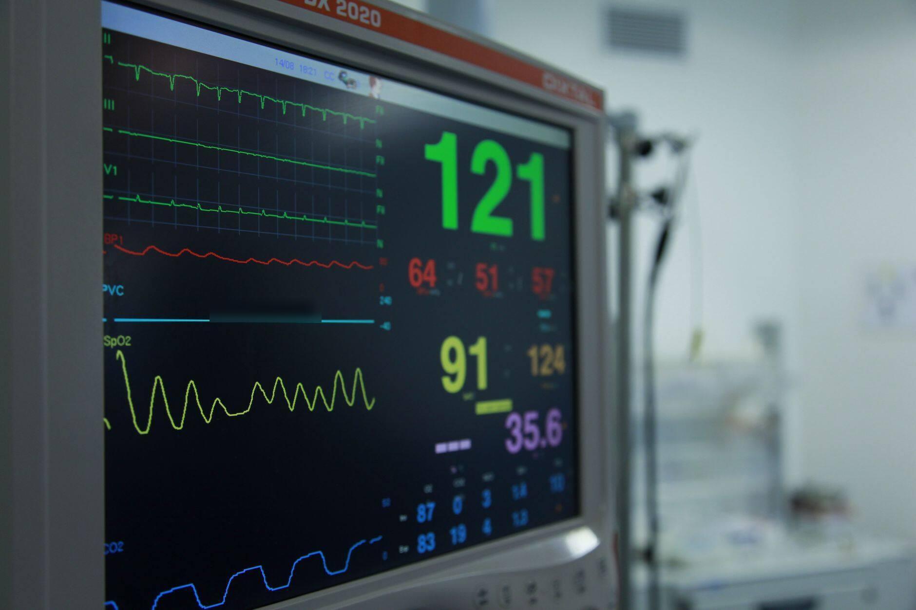 Patient monitor in a hospital ward